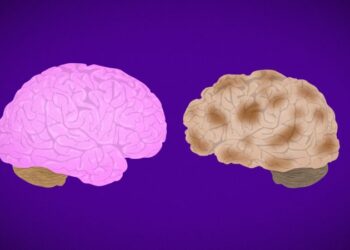 Alzheimer’s Disease Fast Facts | CNN