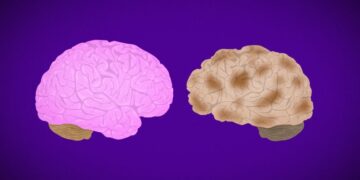 Alzheimer’s Disease Fast Facts | CNN