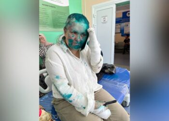 Prominent Russian journalist ‘severely beaten’ in attack in Chechnya | CNN