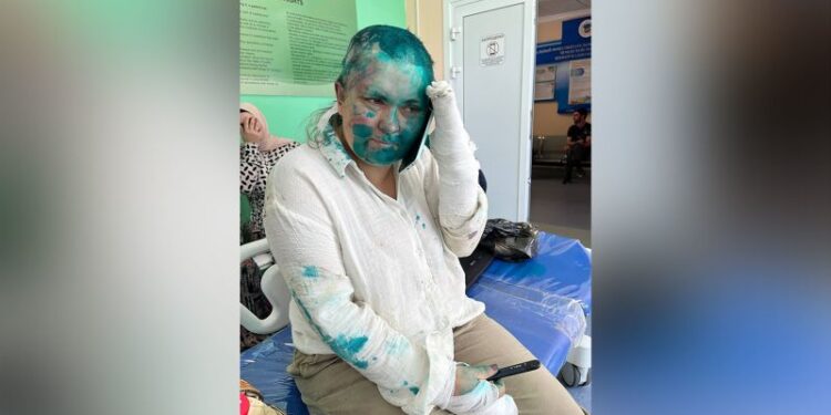 Prominent Russian journalist ‘severely beaten’ in attack in Chechnya | CNN