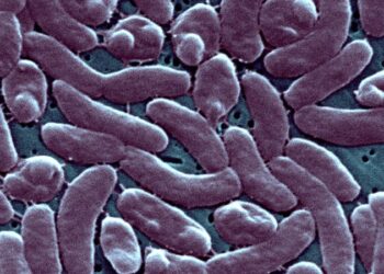 3 people have died after infection with rare flesh-eating bacteria in Connecticut and New York | CNN