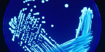 Polish authorities probe whether deadly Legionnaires’ outbreak was result of water tampering | CNN